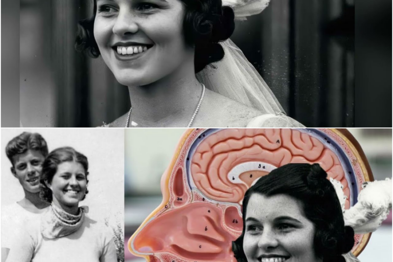 Rosemary Kennedy: The Kennedy Daughter Erased After a Lobotomy – H